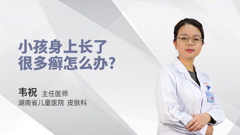 小孩身上长了很多癣怎么办